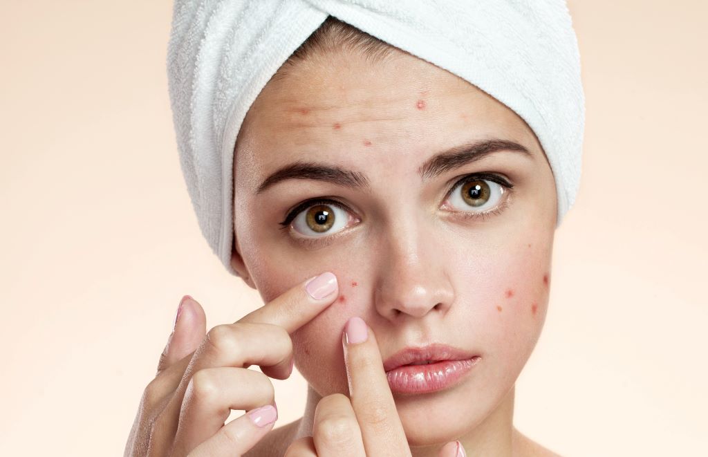 Person examining acne on their face closely.