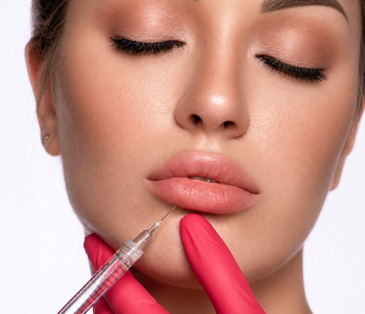 Lip Filler