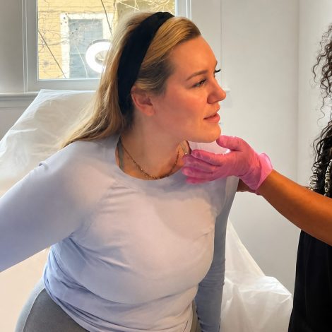 Sculptra® treatment