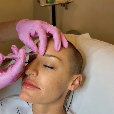 Dysport® Forehead Treatment