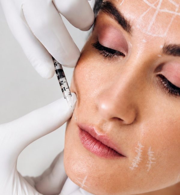 Sculptra filler