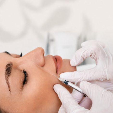 Smile line treatment